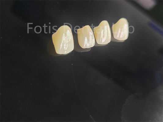 Good price Professional Grade Porcelain Fused Zirconia For Perfectly Fitting Dental Restorations online
