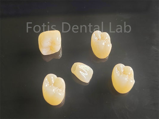Good price Aesthetic Appeal Full Porcelain Layered Zirconia Ideal For Crowns Bridges online