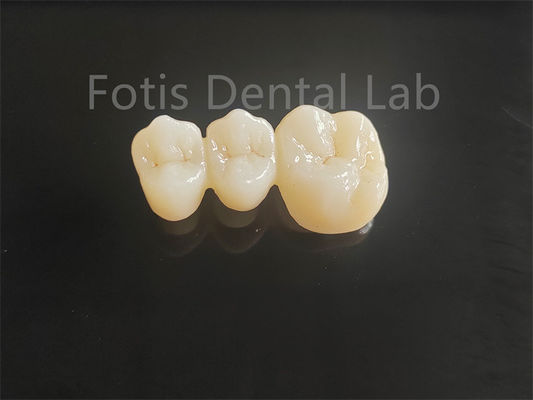 Good price High Strength Porcelain Layered Zirconia For Long Lasting Dental Bridges online