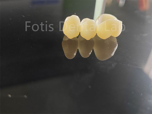 Good price Dental Industry Zirconia Layered With Porcelain Long Lasting Solution online