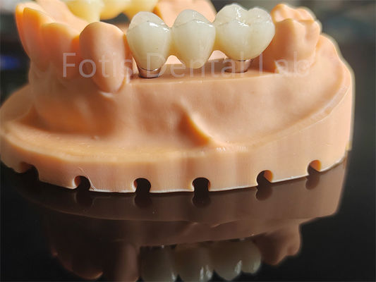 Good price High Toughness Zirconia Based Ceramics Material For Dental Applications online