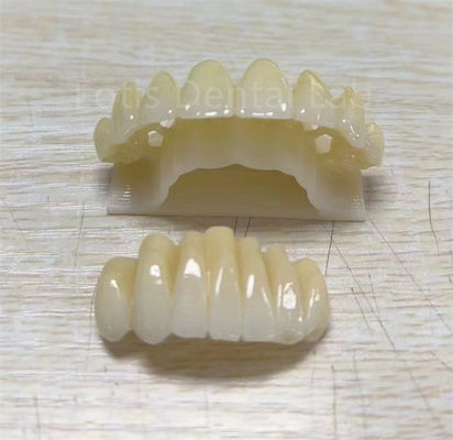Good price Precision Zirconia Multilayer Product For Improving Fracture Resistance online