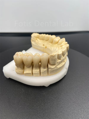 Good price Good Performance Dental Zirconia Multilayer The Ultimate Ceramic Solution online