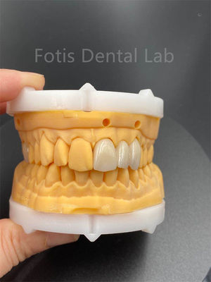 Good price High Durability Multilayered Zirconia Dental Ceramics For Dental Lab Medical Product online