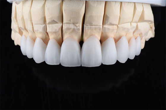 Good price Crack Resistance Zirconia Multilayer Ceramic Ultimate Solution For Industrial Efficiency online