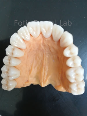 Good price Advanced Multi Layered Zirconia For Superior Wear And Corrosion Resistance online