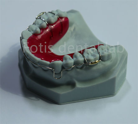 Good price China Dental Lab Retainer Expander For Dental Retention And Expansion online