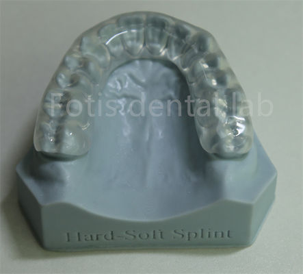 Good price Adjustable And Customizable Orthodontic Retainer Expander For Teeth Retention And Expansion online