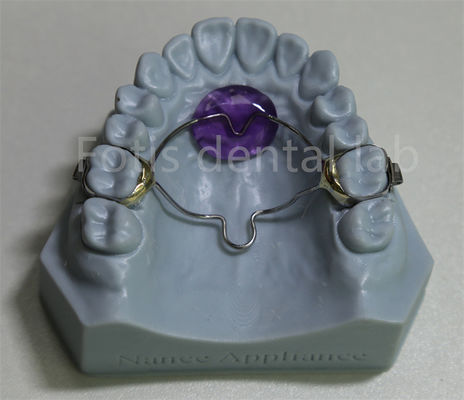 Good price Dental Lab Affordable Orthodontic Expander Retainer Effective In Retaining And Expanding Teeth online
