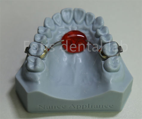 Good price Dental Lab Orthodontic Palatal Expander Affordable and Compatible with Most Treatments online