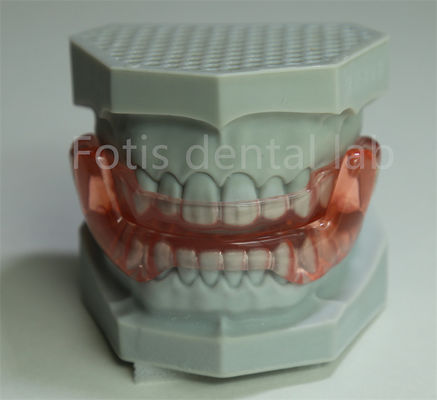 OEM Orthodontic Retainer Expander All Sizes Compatible With Most Orthodontic Treatments